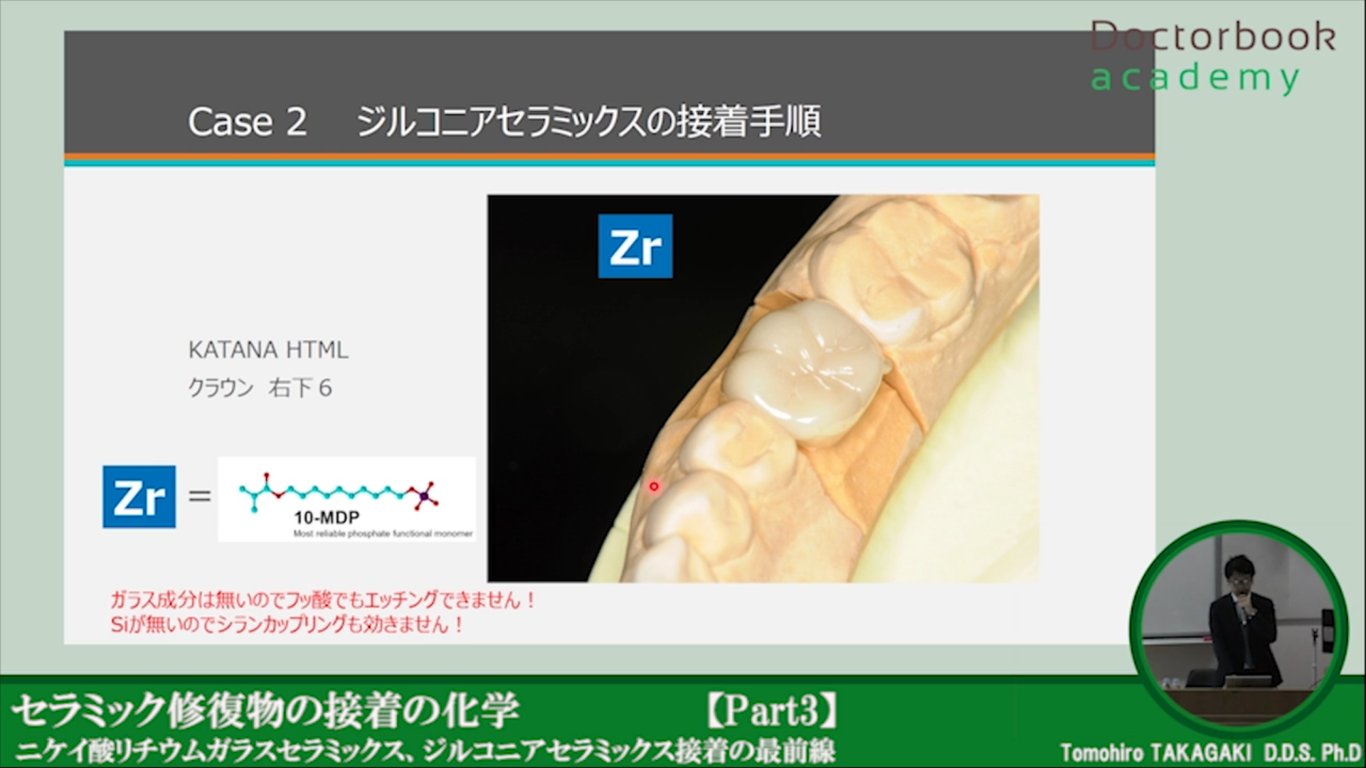 Special】セラミック修復物の接着の化学 ~最前線に迫る